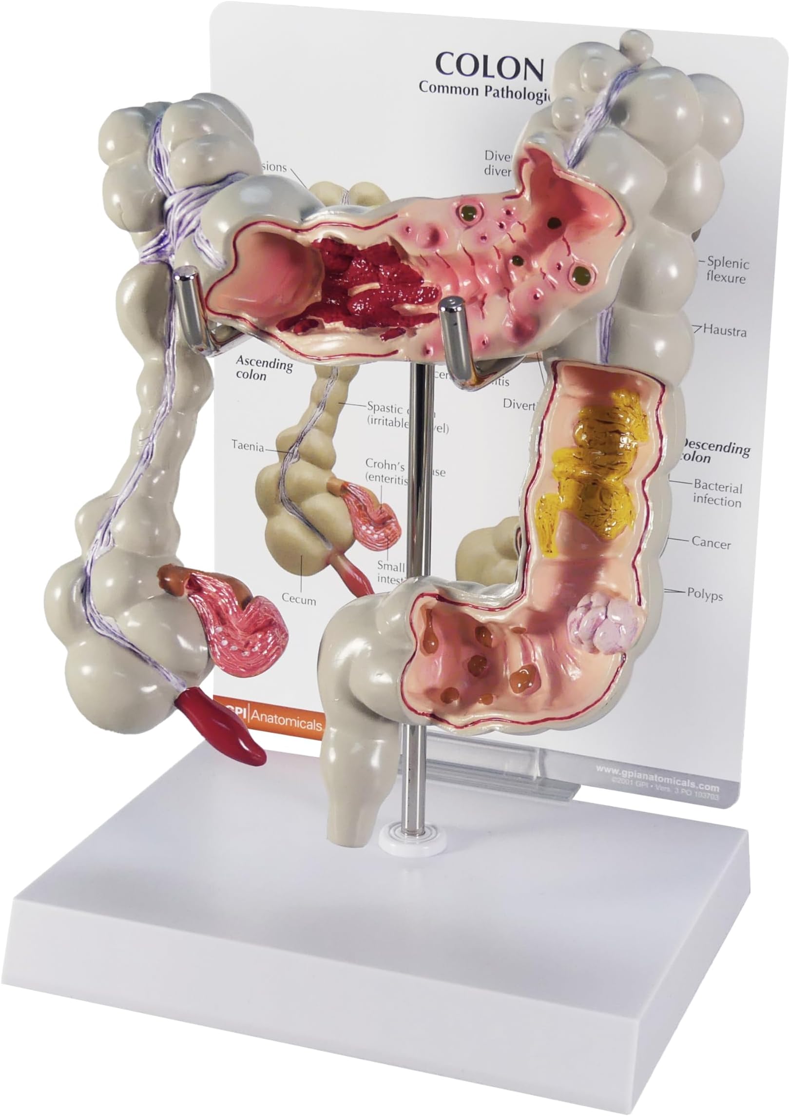 GPI Anatomicals - Colon Model, Replica for Human Anatomy and Physiology Education, Anatomy Model for Doctor's Offices and Classrooms, Medical Learning Resources