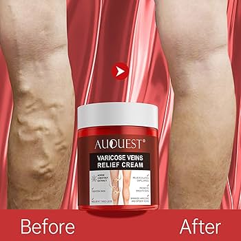 Varicose Veins Crema, 2024 Nueva Crema para Varices para Piernas, Crema de Ungüento de Algas Contra las Venas Vasculares, Crema Eliminar Las Venas Vasculares, Crema de Cuidado de las Piernas, Eliminar :
