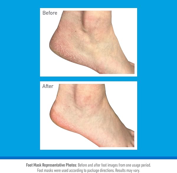 O’Keeffe’s Healthy Feet Foot Mask – Intensive Moisturising Sock Treatment for Extremely Dry, Rough Feet & Cracked Heels – Visible Results in One Use - 4