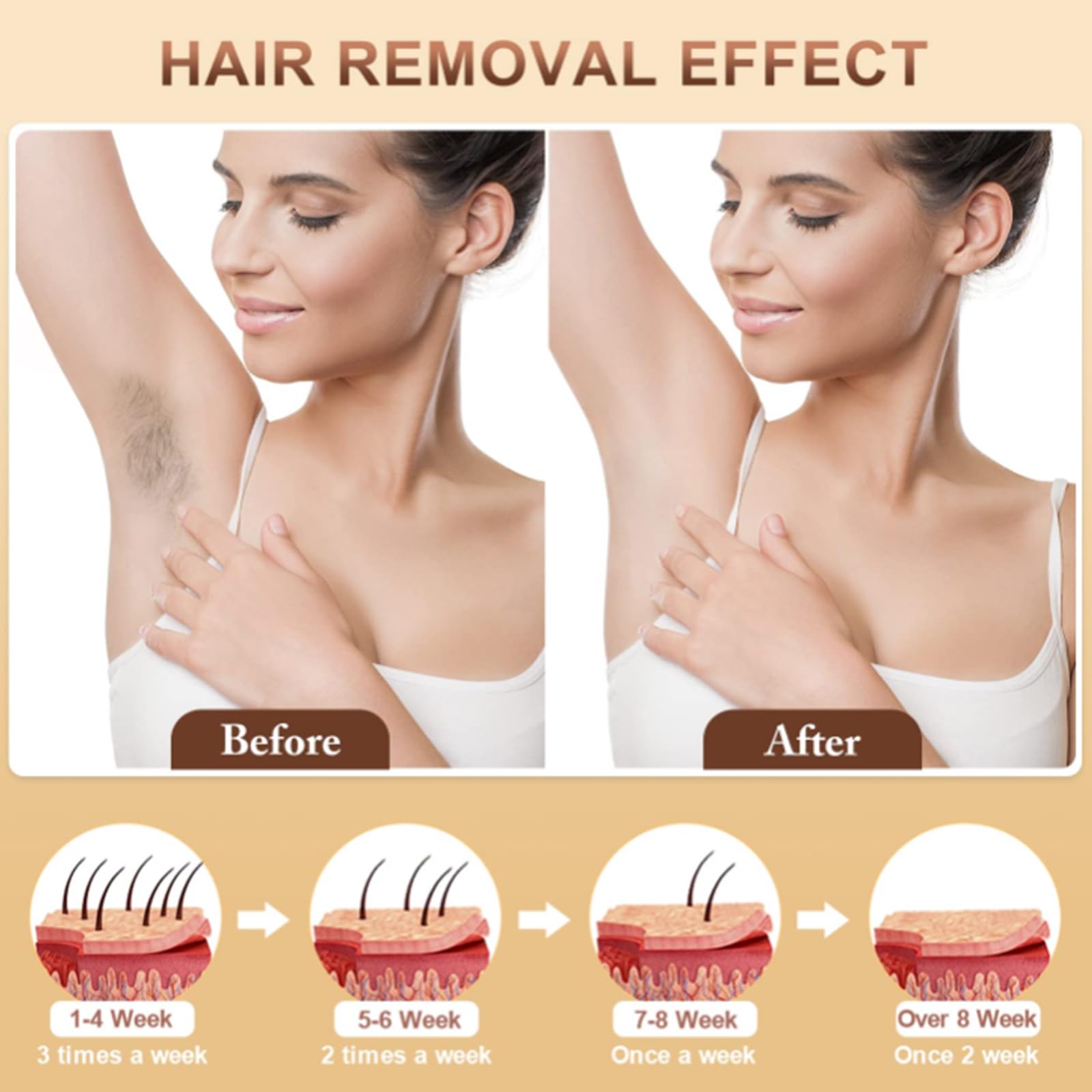 IPL -Laser - Geräte Haarentfernungs für Frauen und Männer, 9 Energieniveaus, 999.000 Blitze, zu Hause sicher für Gesicht, Körper, Bikini & Back