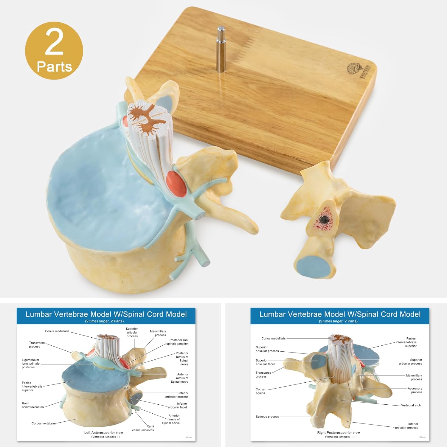 EVOTECH SCIENTIFIC Enlarged Human Lumbar Vertebra Model with Spinal Cord & Cauda Equina – 2 Times 2 Parts Detachable Spine Model on Base with Manual - Anatomy Model for Medical Students Clinicians