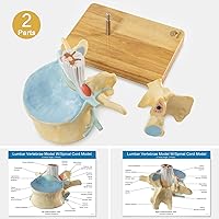 Vista 4 de EVOTECH SCIENTIFIC Modelo de vértebra lumbar humana agrandada con médula espinal y equina cauda – 2 veces 2 piezas modelo de columna vertebral