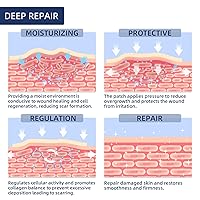 Vista 5 de Cinta de silicona para cicatrices quirúrgicas, rollo de 120 x 1.5 pulgadas, hojas de cicatrices extralargas para cesáreas, abdominoplastia