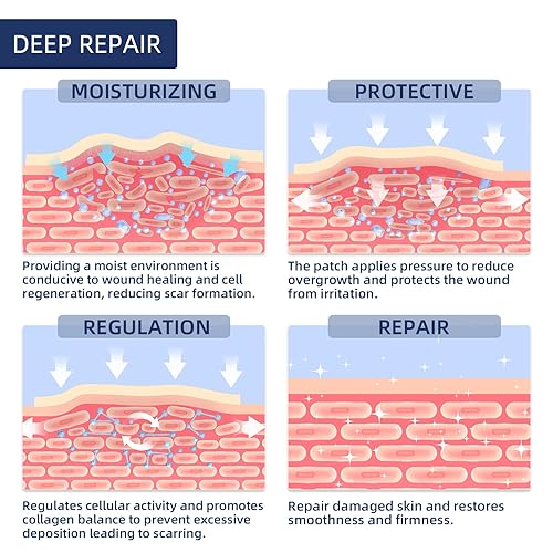 Miniatura 3 de Cinta de silicona para cicatrices quirúrgicas, rollo de 59 x 1.5 pulgadas, hojas de cicatrices extralargas para cesáreas, abdominoplastia, queloides