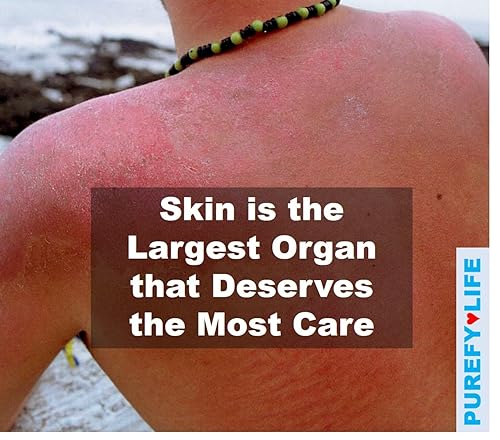 Miniatura 2 de Aerosol tópico (3.4 onzas, 2 unidades) Spray calmante para la piel de la cara y el cuerpo, tecnología Purefypro Dermal HOCL, soporte natural para el