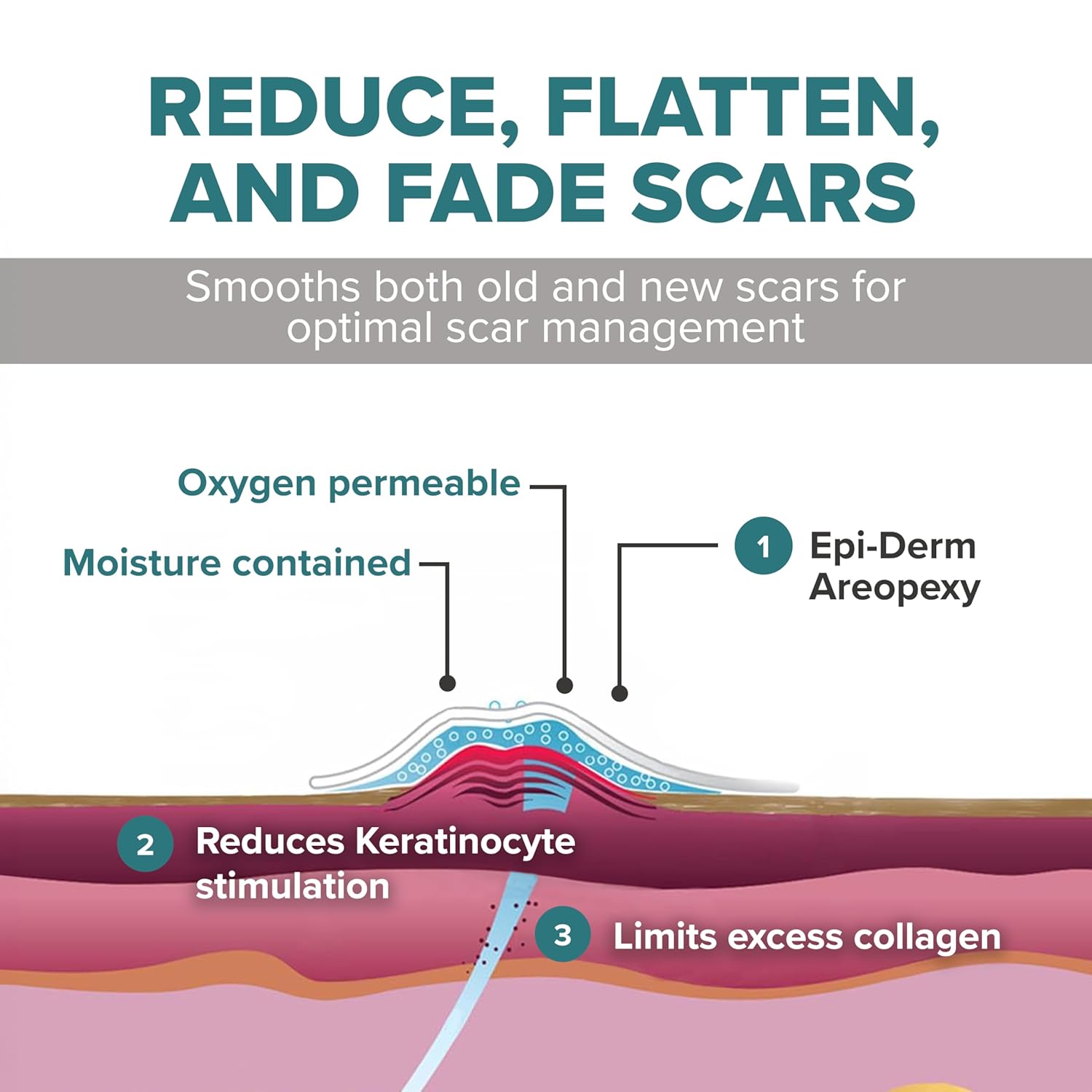 EpiDerm Areopexy Silicone Scar Sheets – Medical Grade Silicone Scar Tape for Breast Surgery – Reusable, Washable & Customizable Post Op Breast Reduction Essentials – Lollipop Shape Pair - Image 4