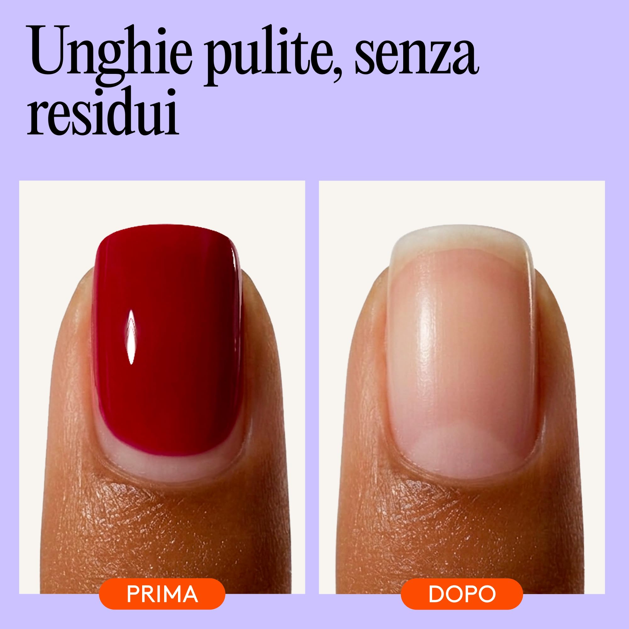 Mylee, solvente per unghie di qualità superiore, 100% puro acetone, adatto per smalti Gel UV/LED soak off