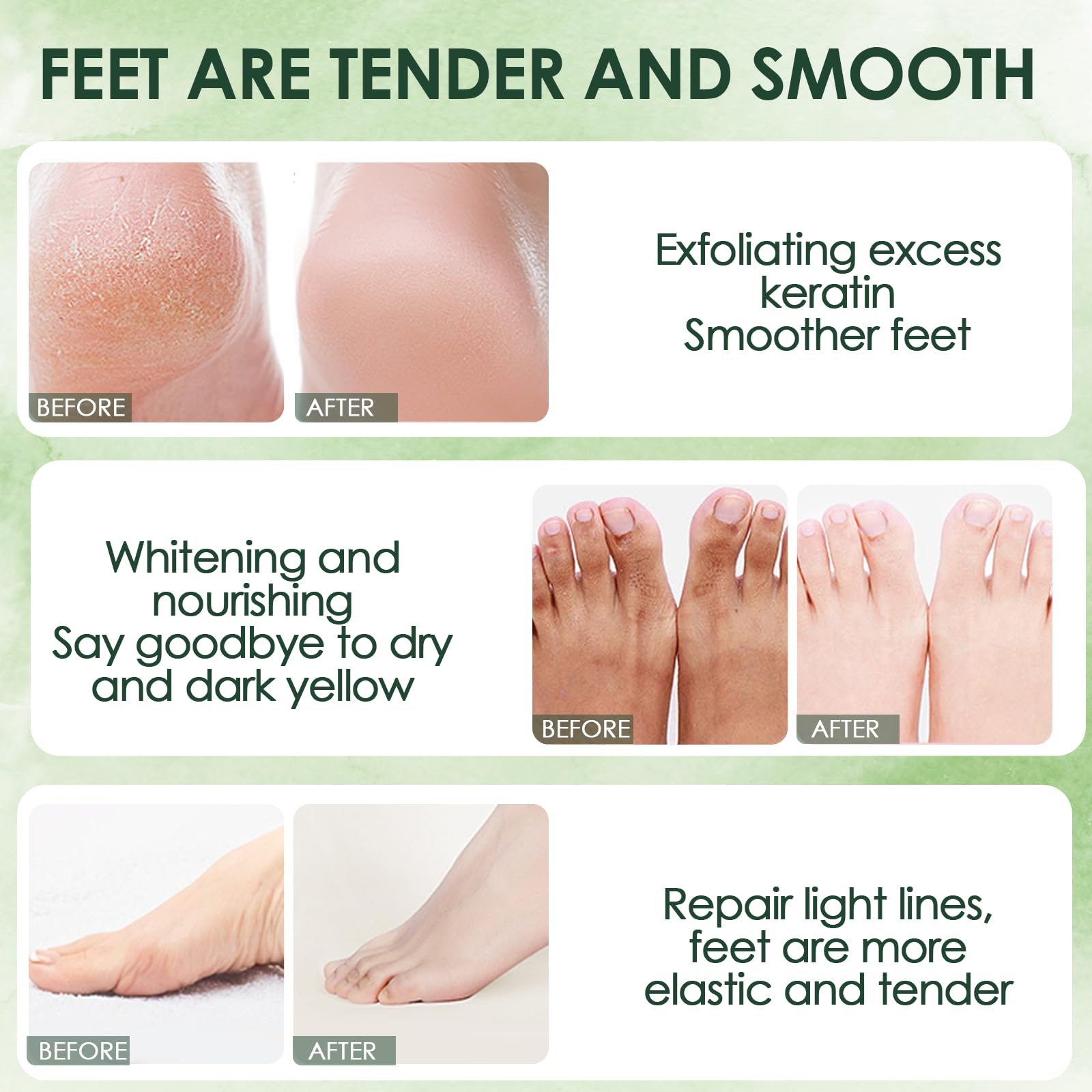 2 Paia Maschera Piedi Esfoliante, Rimuove Pelle Morta Ripara Talloni, Maschera idratante i piedi una pelle liscia per uomini e donne (Aloe Vera + Avocado)