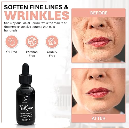 Miniatura 2 de Suero facial - Combate las imperfecciones - espinillas y brotes de acné - Suaviza las líneas finas y las arrugas - Hidrata y repara la piel dañada -