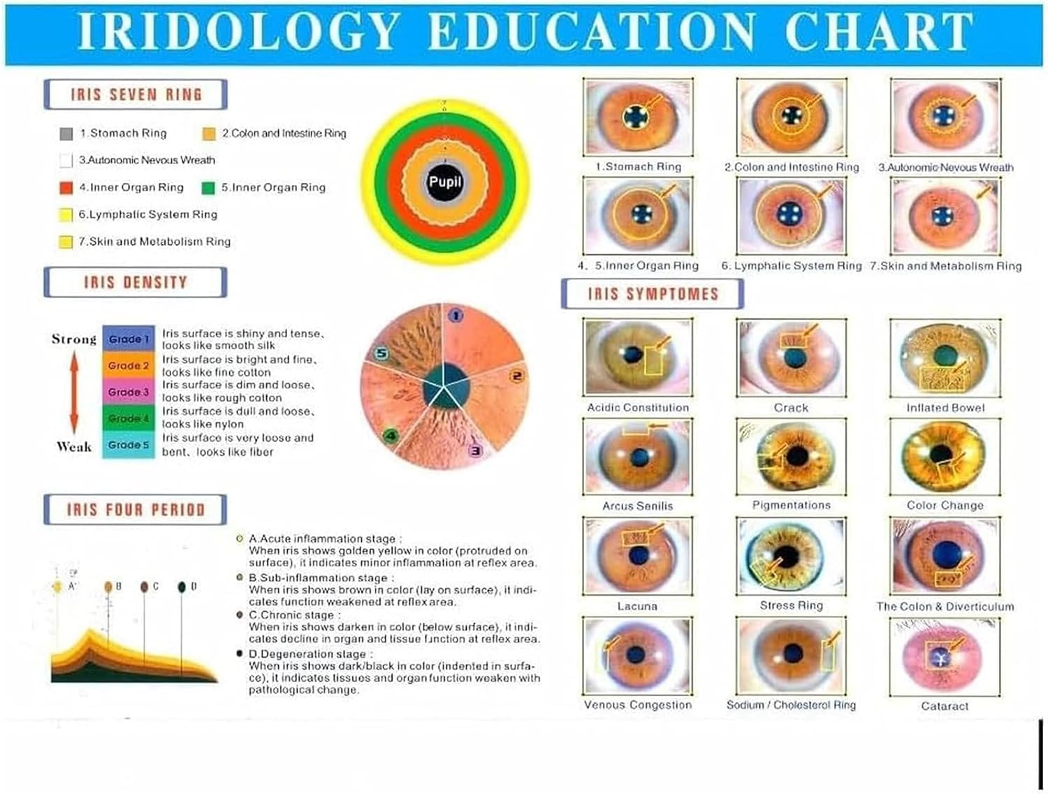 Iridology Camera, Iriscope Iris Analyzer,Iris Eye Detector,Iris Camera,Iris Lens,with Aluminum Box + Hd 13 Million Pixel + Iris Analysis Software, for Beauty Salon, Spa