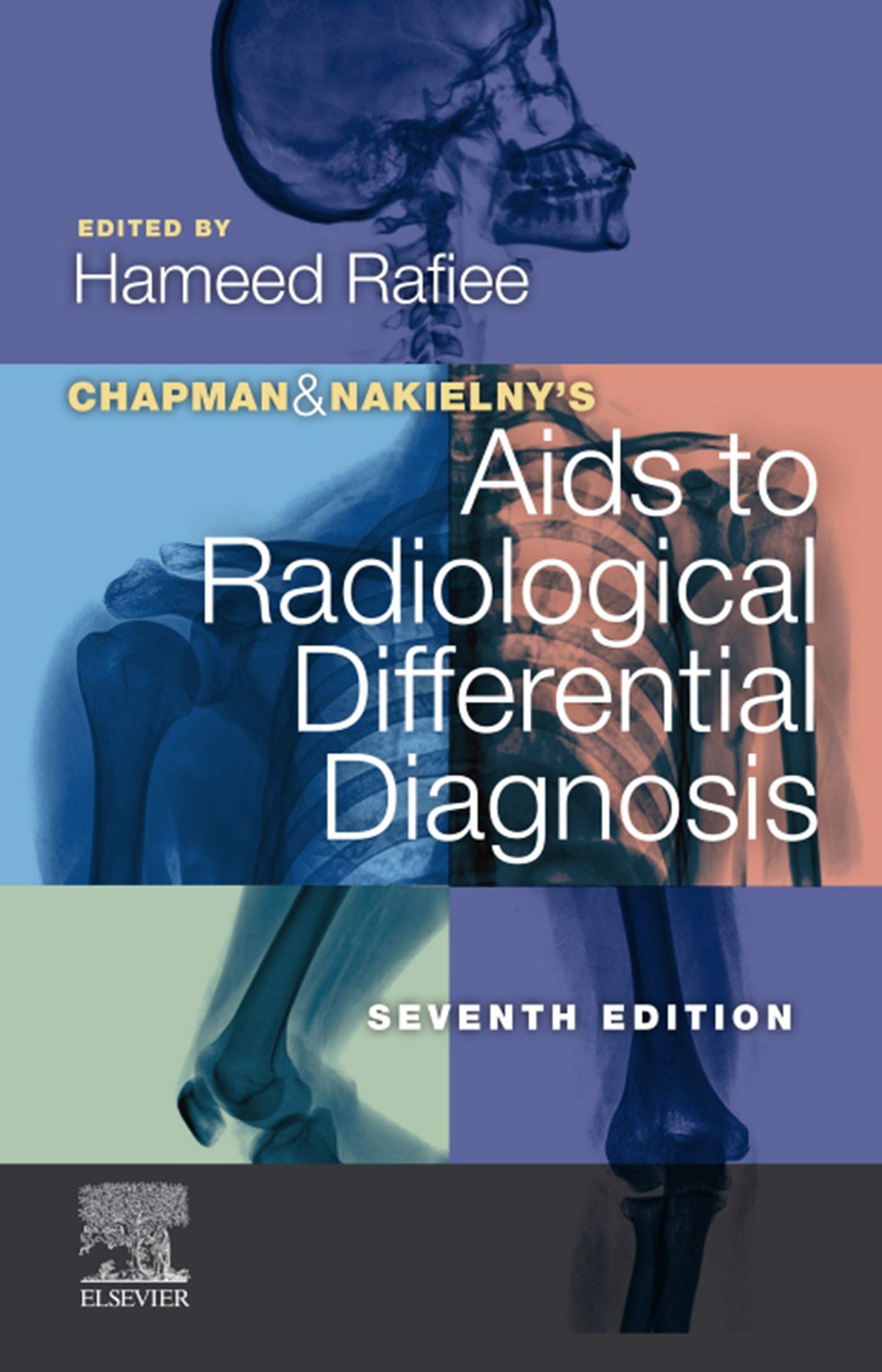 Chapman & Nakielny's Aids to Radiological Differential Diagnosis: Expert Consult - Online and Print