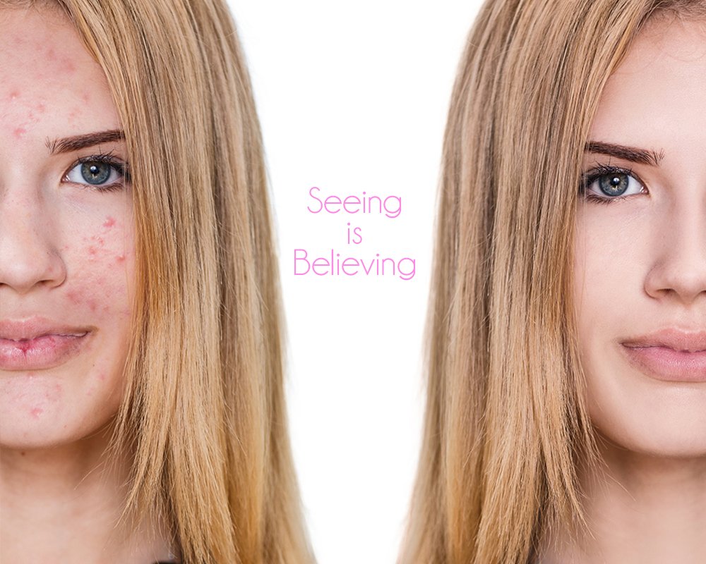 Dinair Airbrush Makeup Foundation | 4pc Camouflage Neutralizer Set | Fair Shades | Covers Scars, Acne, Tattoos, Under Eye Circles, Sun Spots, Vitiligo