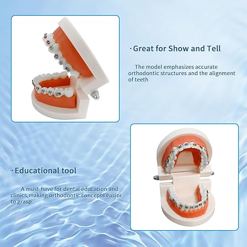 Miniatura 5 de Modelo de dientes de ortodoncia dental con aparatos ortopédicos coloridos, modelo profesional de boca de dentadura para demostración de estudio para