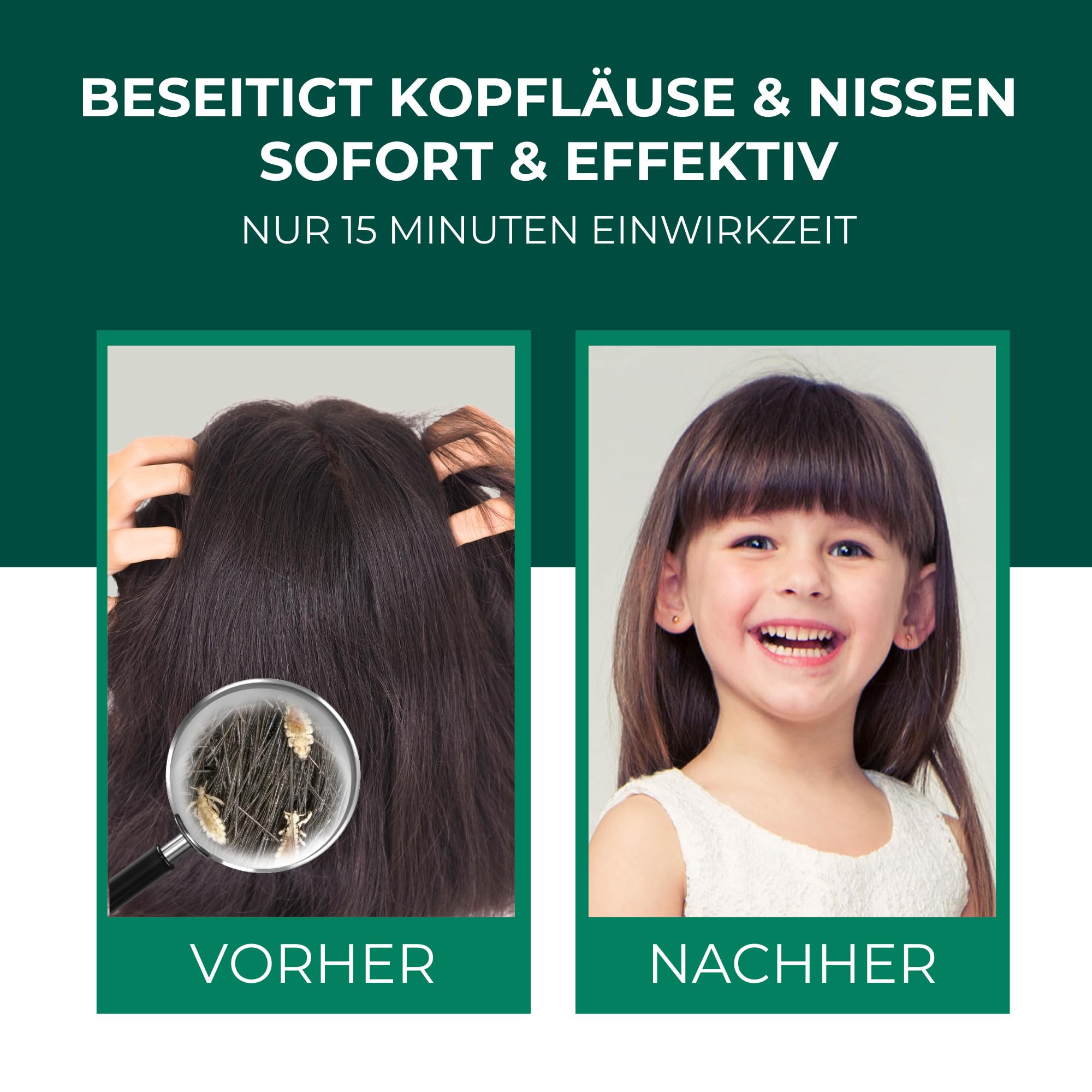 Silberkraft Shampoo gegen Läuse und Nissen Family, Medizinprodukt ab 6 Monate, mit Nissenkamm, 15 Min Einwirkzeit, für Kinder & Erwachsene, 100 ml