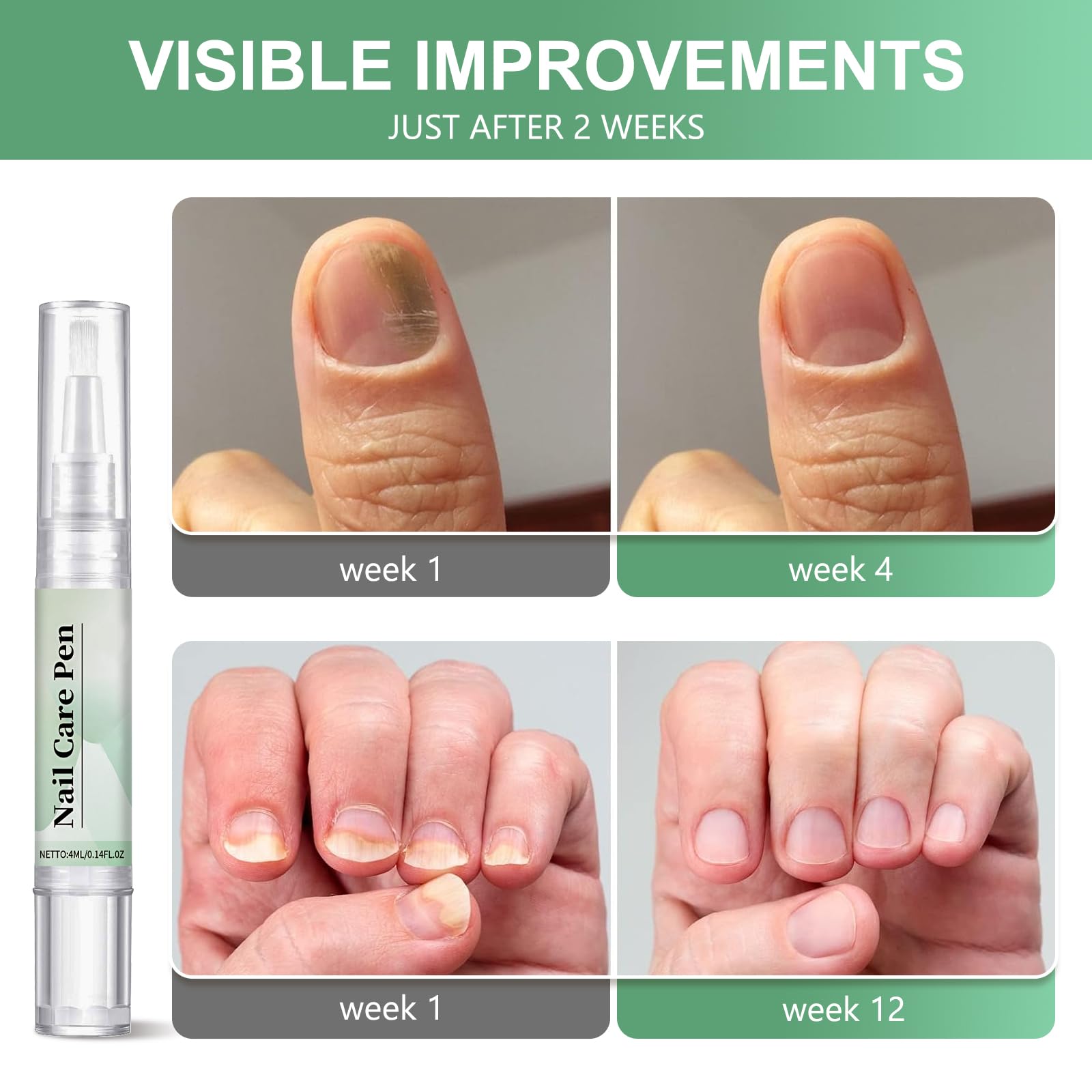 Nail Care Pen - Set di 3 penne per unghie curate e unghie dei piedi con olio di tea tree, vitamina E e aloe vera