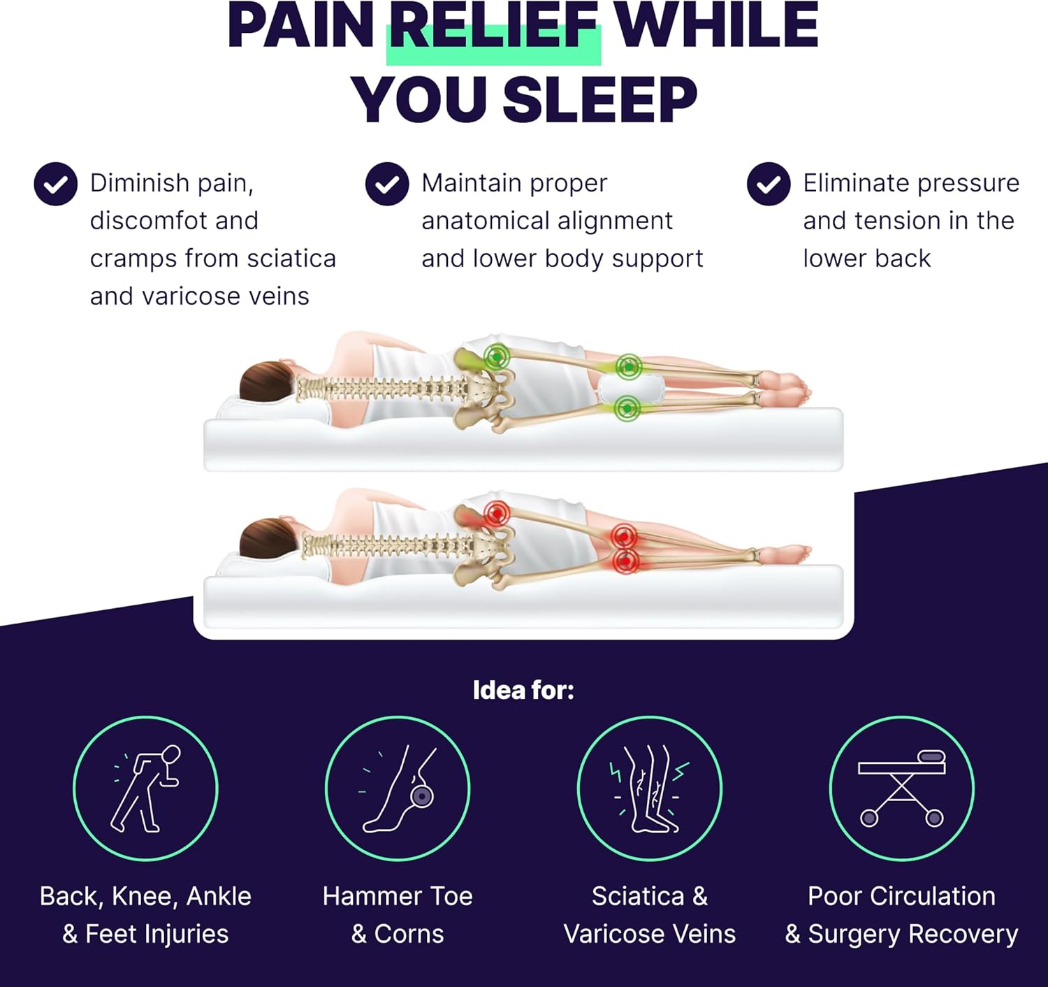 Back Support Systems Knee-T Knee Pillow for Side Sleepers – Memory Foam Leg Pillow for Side Sleeping with 1 Elastic Strap and Sherpa Cover - Supports Lower Back, Hip and Leg Positioning, Standard