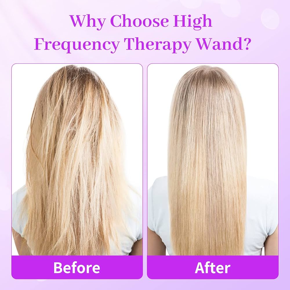 Share 146+ high frequency machine for hair best ceg.edu.vn