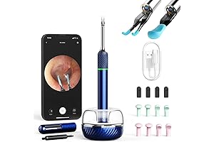 Bebird Note5 Pro Ear Cleaner Otoscope Camera: Professional Telehealth Ear Wax Removal Tool