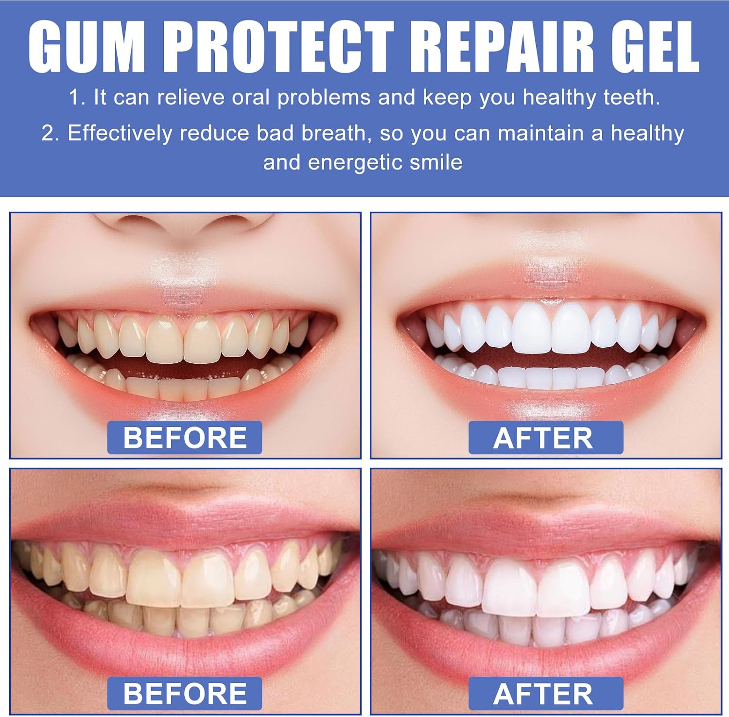 3PCS Gum Protect Dental Gel, Professional Gum Health Solution