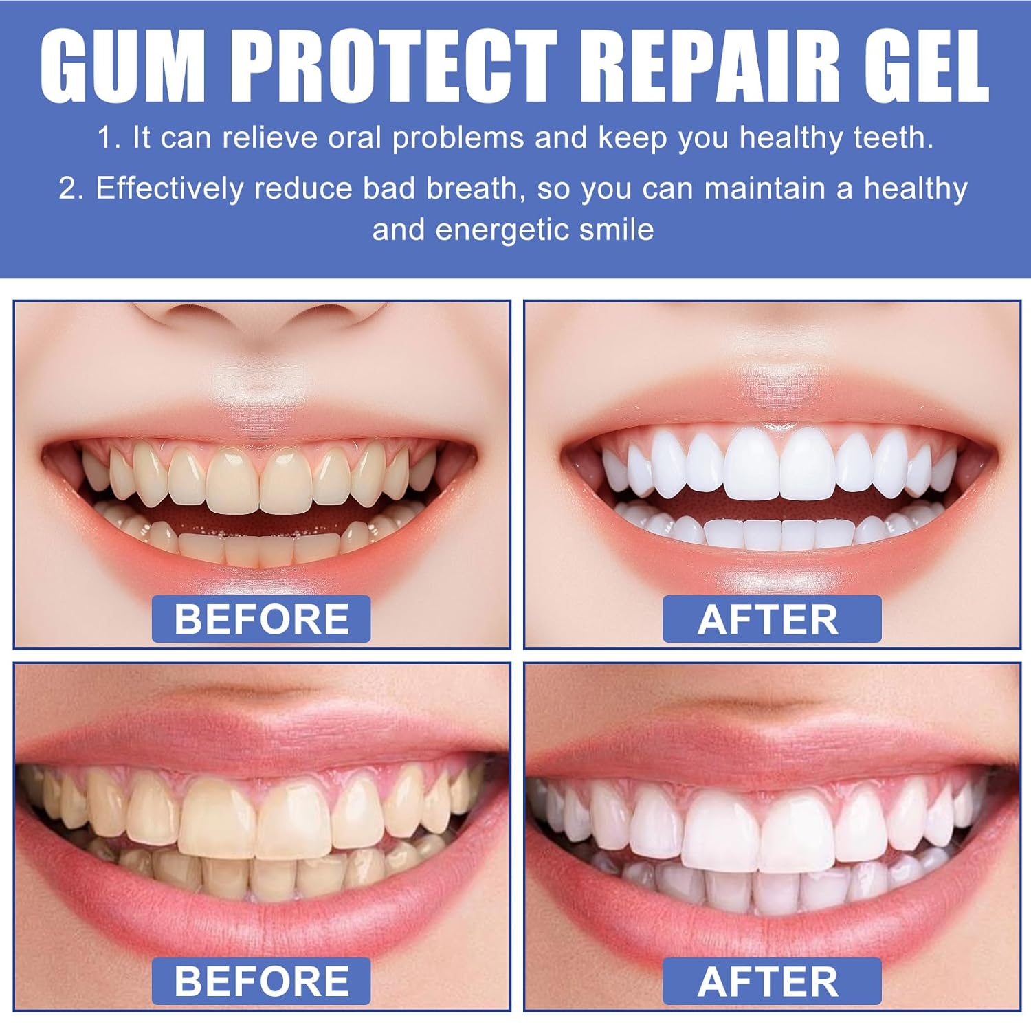 2 Boxes Gum Protect Dental Gel, Deep Cleaning Oral Gel,Fresh Breath Support, Soothing Gum Care and Moisturizing Teeth Gel (1ML x 6)