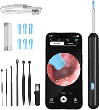 ExtraLux Earocam Earwax Removal Tool Kit with HD Camera Wifi Connection & 6 LED Lights Endoscope Tool Ear Cleaner for iOS & Android + 5 Silicone Tips ...