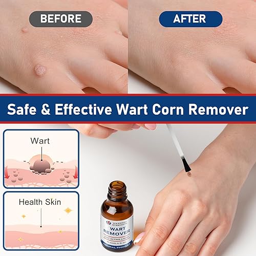 Miniatura 6 de SKAYAH Removedor de verrugas, tratamiento a base de plantas de acción rápida de 0.5 fl oz, removedor de verrugas sin dolor para maíz, verrugas H,