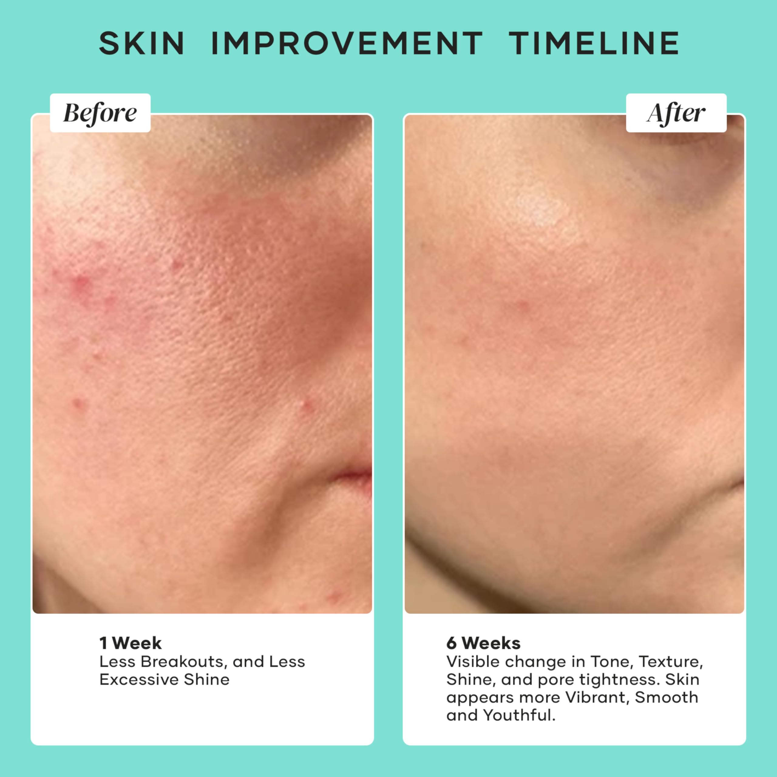 Amazon.com: DERMAdoctor Pore Minimizer Niacinamide Serum for Face