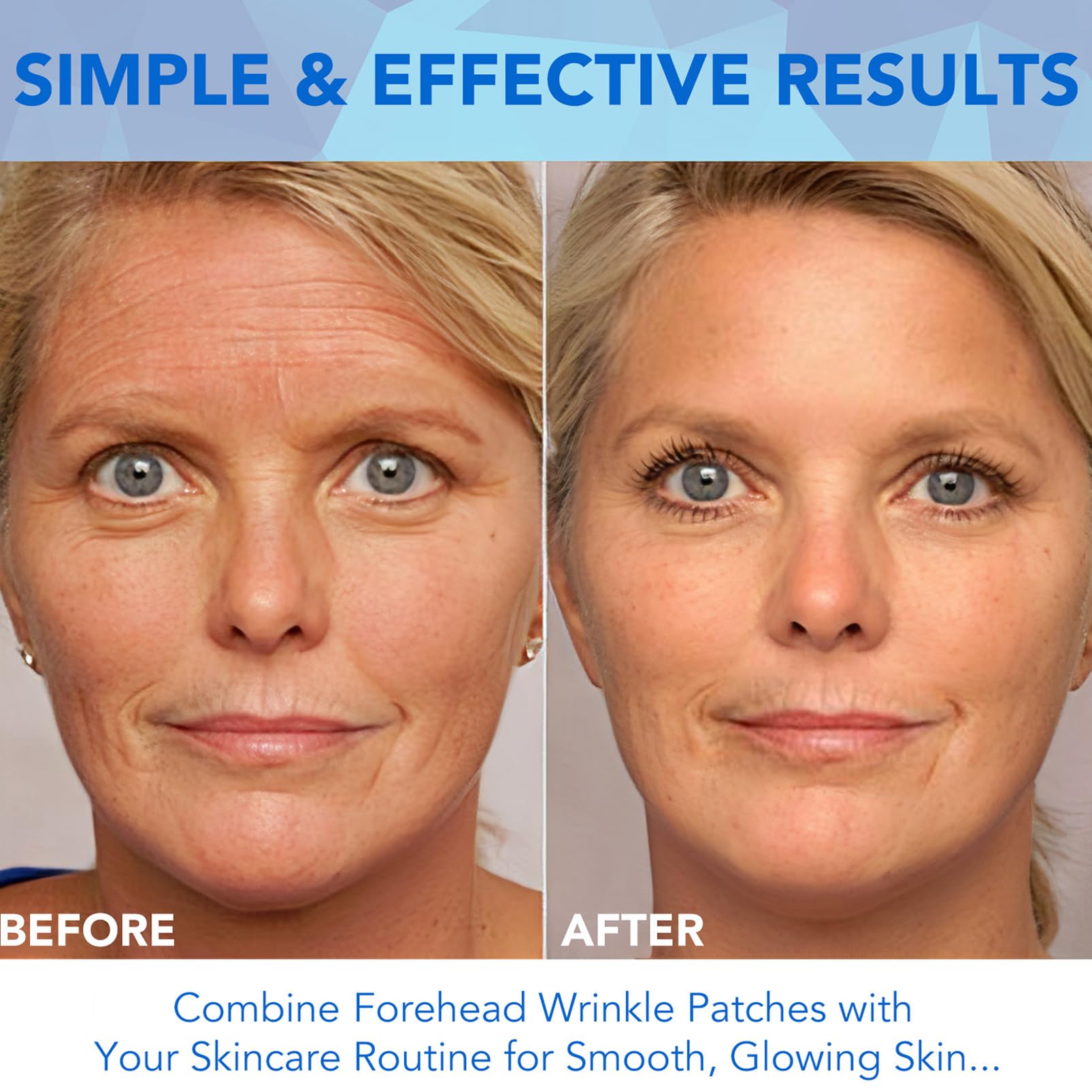 Forehead Wrinkle Patches, Anti Wrinkle Patches with Aloe Vera & Collagen - Image 2