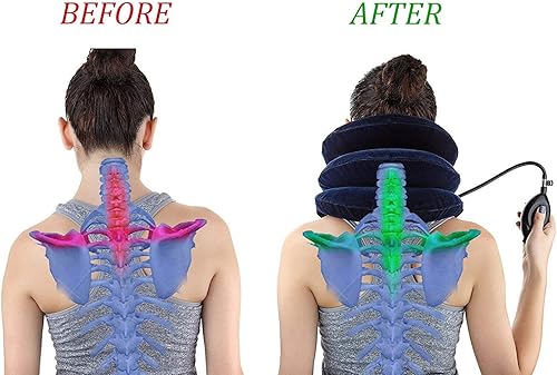 Miniatura 3 de Dispositivo de tracción cervical para el cuello inflable fácil de usar para aliviar el dolor crónico de cuello y hombros almohada cervical para el