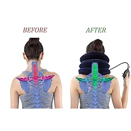 RUNZI Cervical Neck Traction Device Inflatable Neck Stretcher, Easy to Use for Chronic Neck and Shoulder Pain Relief Traction Spine Alignment, Neck Cervical BraceBlue