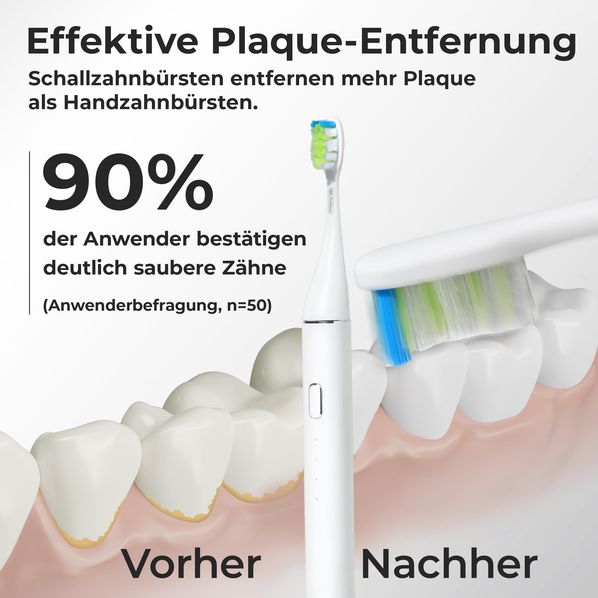 WhyteDOT® Schallzahnbürste Testsieger 2026* – leise Schallzahnbürste aus Aluminium statt Plastik, für empfindliche Zähne, UV-Reiseetui, bis zu 6 Wochen Akku