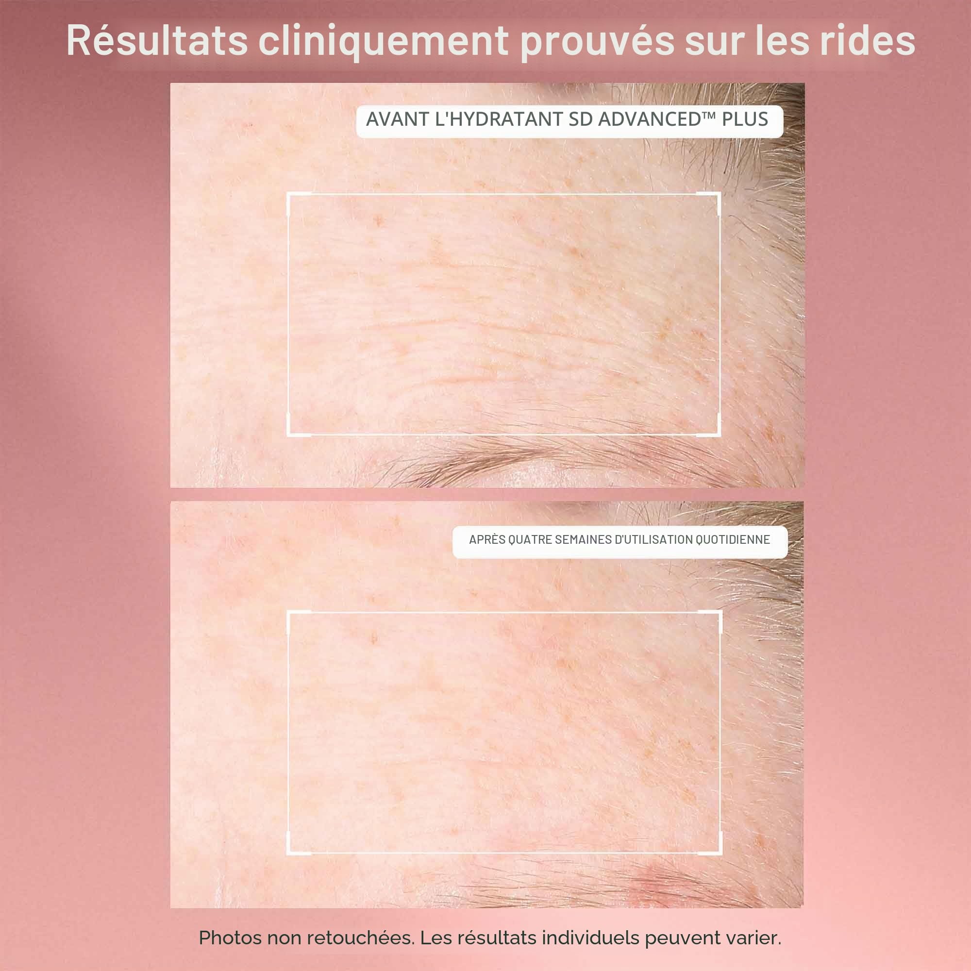 SD Advanced™ Plus Soin Hydratant Intensif Anti-Rides et Anti-Vergetures 118ml