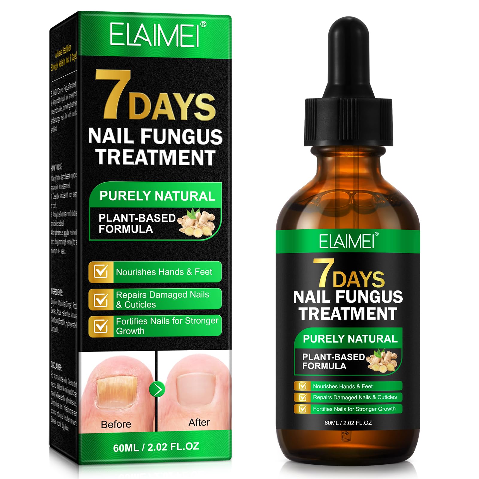 7 Days Nail Treatment, 100% Natural, Infection Removal Ginger Toenail Treatment, Multi-Purpose Professional Nail Repair Serum 60ml