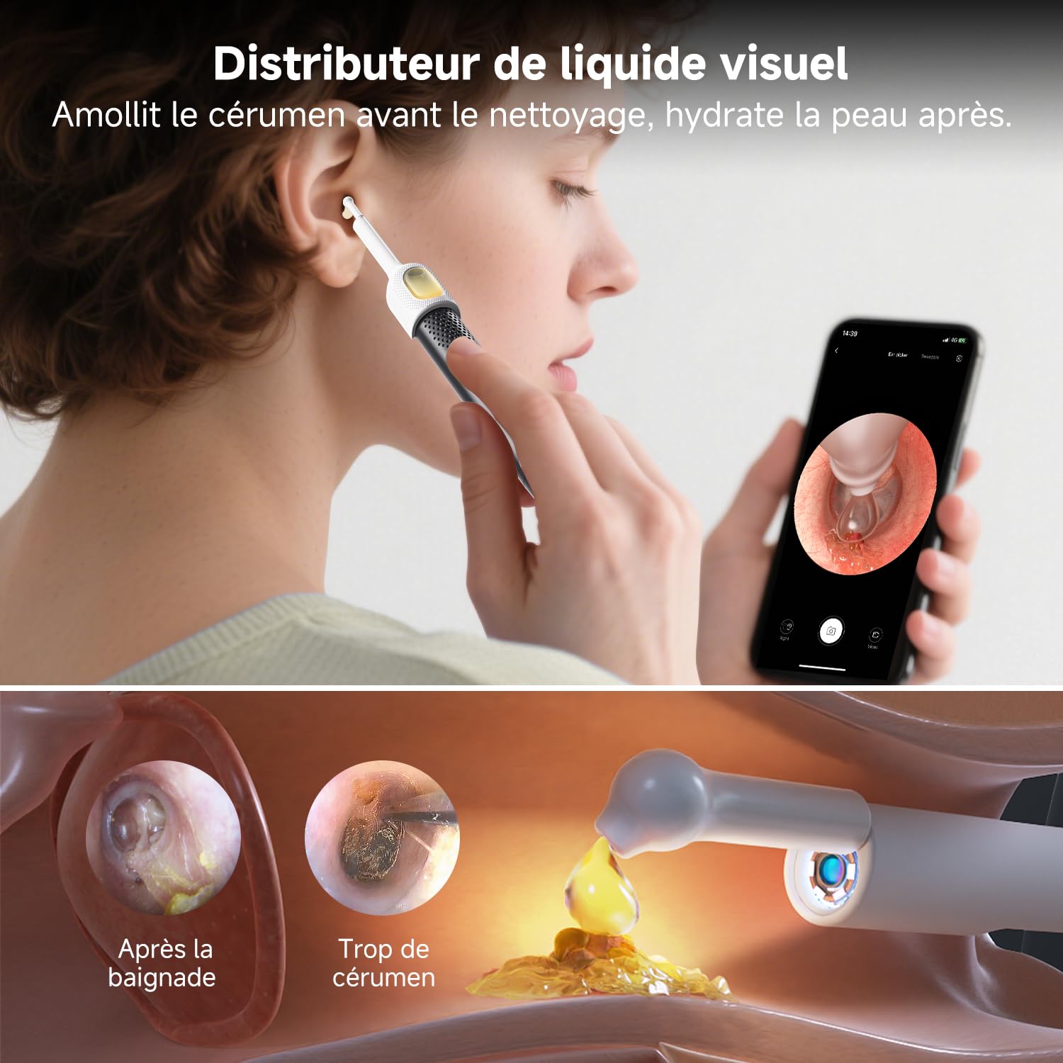 Otoscope Cure Oreille Nettoyage Camera Lumière Kit Élimination Cérumen Domestique