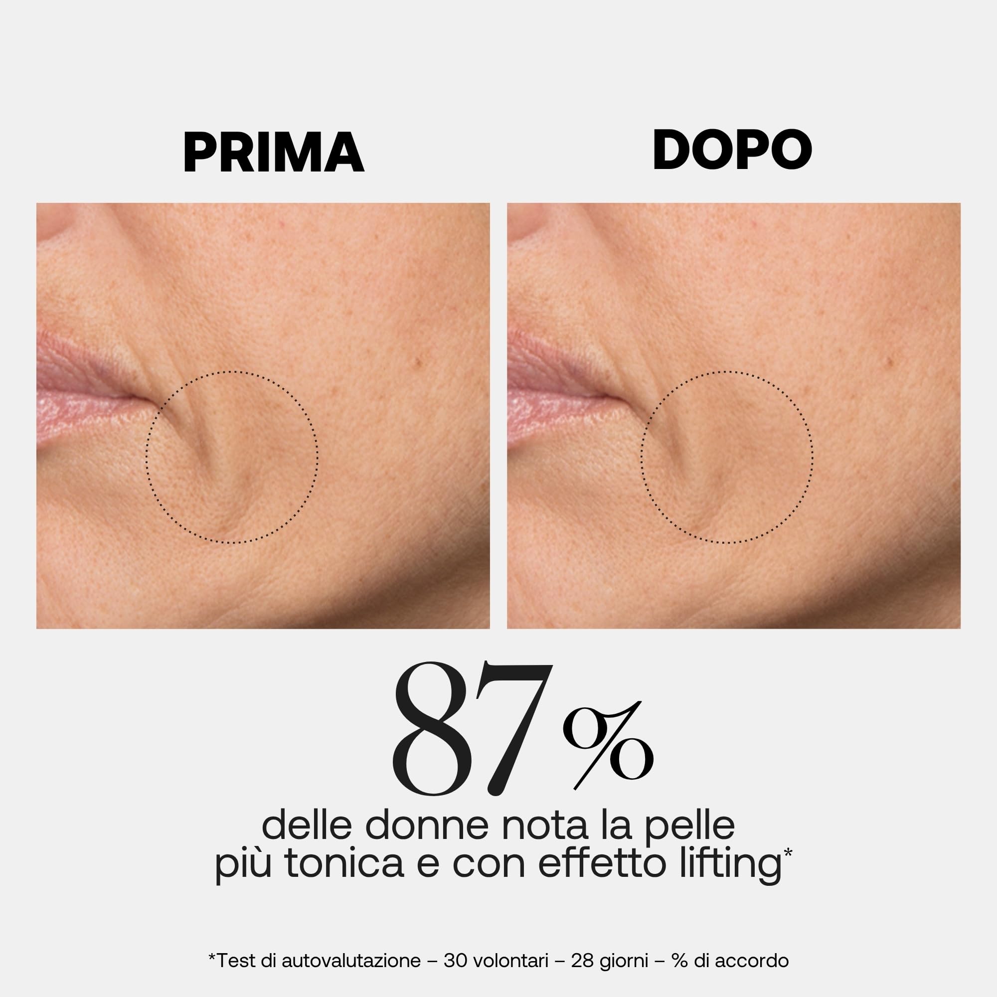 Rexaline Line Killer Lift Siero – Siero Viso Anti-Rughe Effetto Lifting – Acido Ialuronico RX2, Lipopeptidi DWK, Peonia & Peptidi – Ovale Ridefinito & Rughe Attenuate – 30 ml