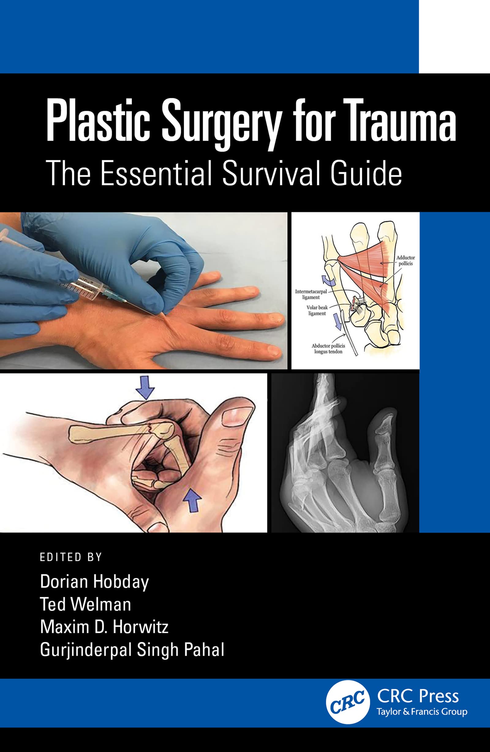 Plastic Surgery for Trauma: The Essential Survival Guide (English Edition)
