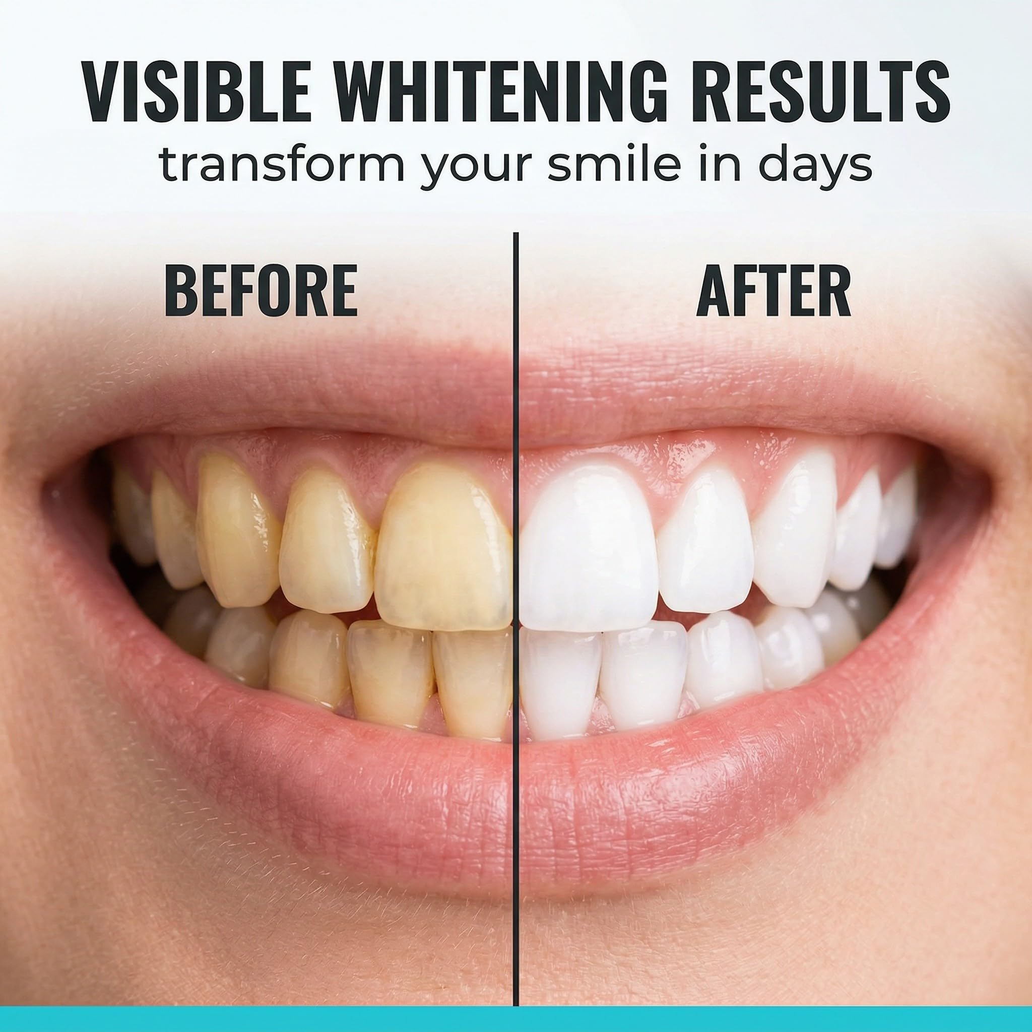 7 Pezzi Cocco Strisce Sbiancanti Denti, Senza Teeth Sbiancamento Dei Denti, Whitening Strips Per Sbiancamento Delicato, Facile Uso A Casa O In Viaggio