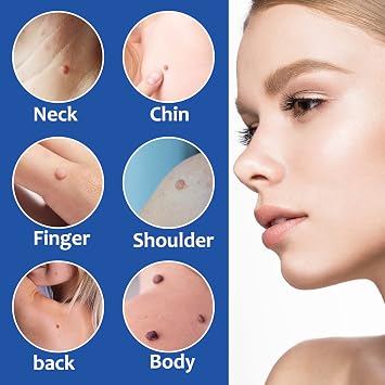 REOKILY Skin Tag Removal Kit with Pen 2-in-1 Skin Tag Remover for 1-9mm Skin Tags Fast Wart Remover and Mole Remover with 60 Bands + 36 Repair Skin Tag Removal Patches for Face, Body Within 3-14 Days