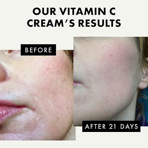 Miniatura 9 de Hidratante facial de ácido hialurónico para mujeres y hombres, loción facial antienvejecimiento, crema facial hidratante antiarrugas, crema