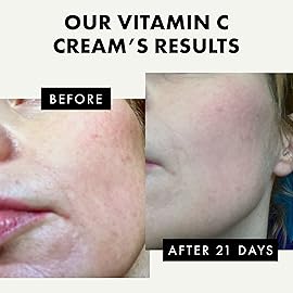 Eclat Skincare Vitamin C Moisturizer for Face with Hyaluronic Acid & Squalane - Face Brightening Cream - Anti Aging, Firming & Hydrating Vitamin C Cream for All Skin Tone 50 ml