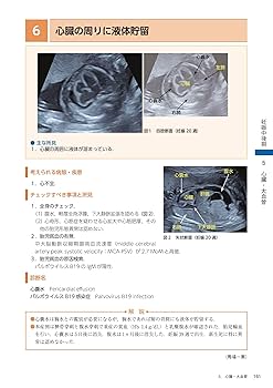 【裁断済】所見から探る 産科 超音波診断 所見から探る 産科 超音波診断 | 馬場一憲 |本 | 通販 | Amazon