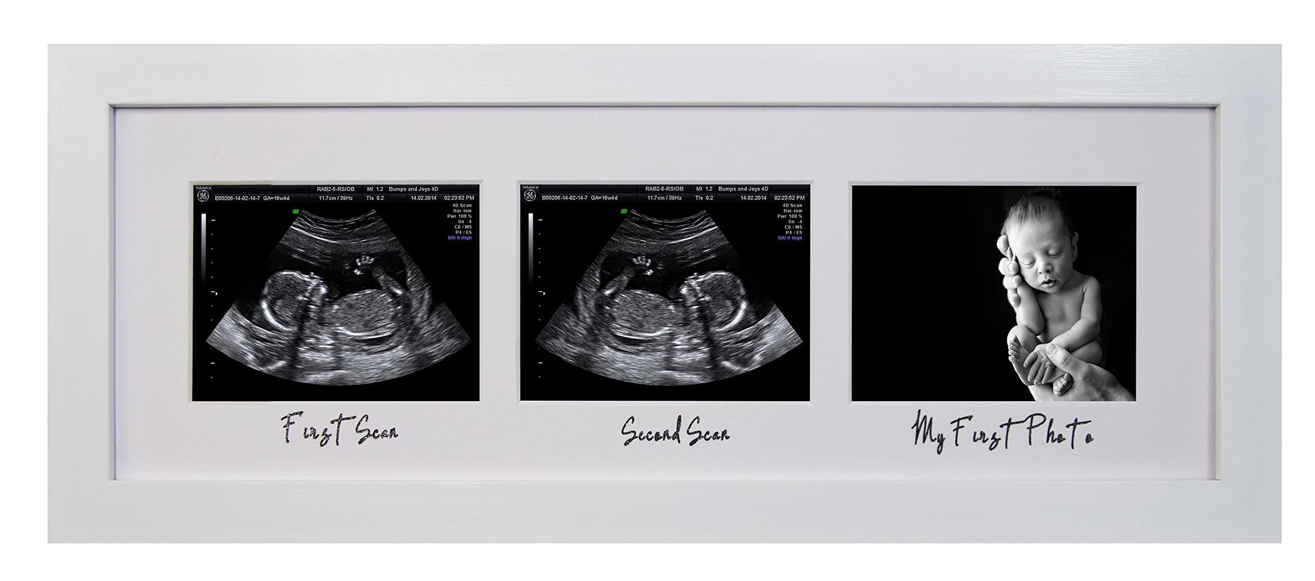 First Scan Second Scan First Photo Triple Aperture Ultrasound Sonogram Baby Scan Picture Frame