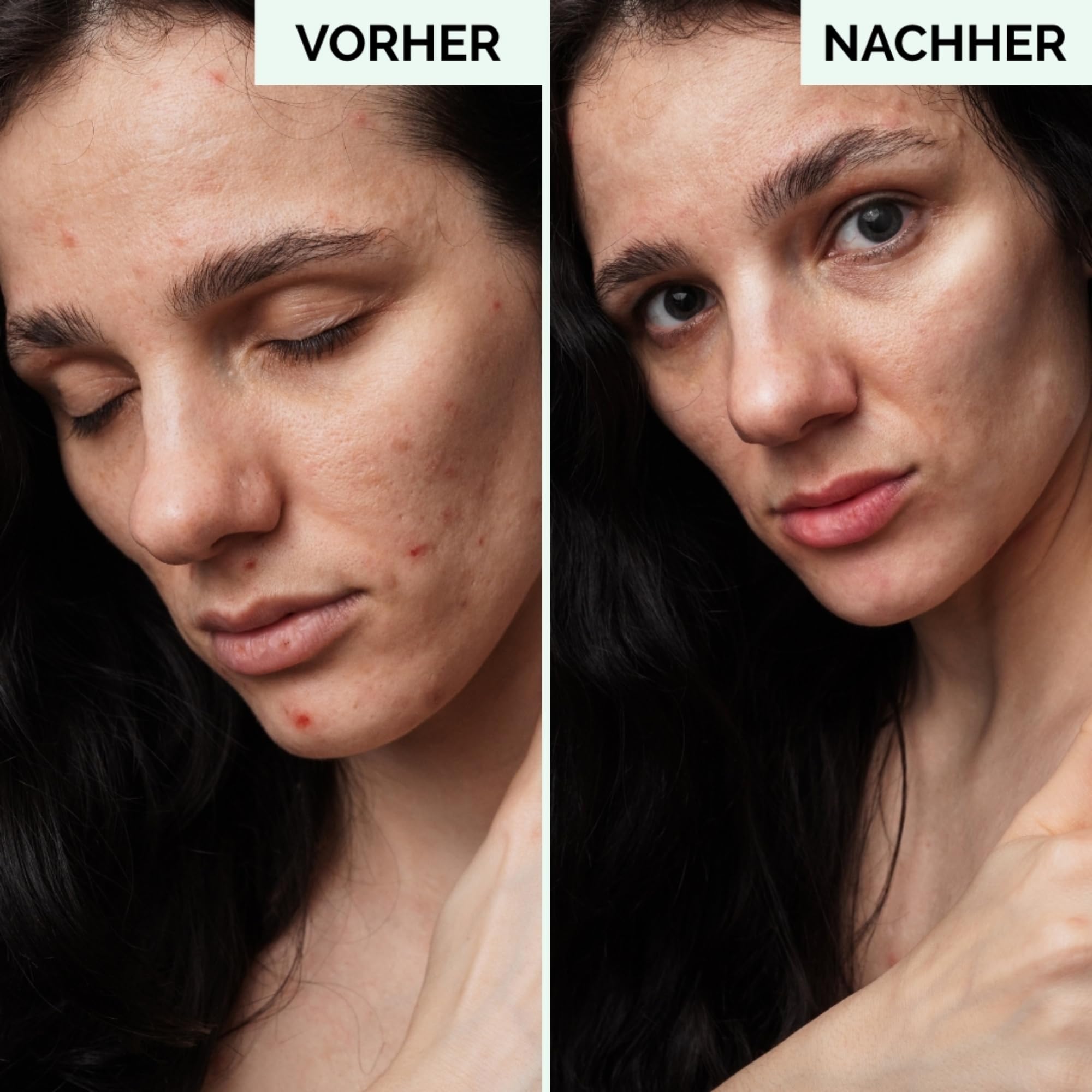 Tonic für sensible Haut – Beruhigendes Gesichtswasser, dermatologisch getestet, parabenfrei & sanft, schützt und pflegt mit natürlichen Inhaltsstoffen, ideal für empfindliche Haut, 250 ml
