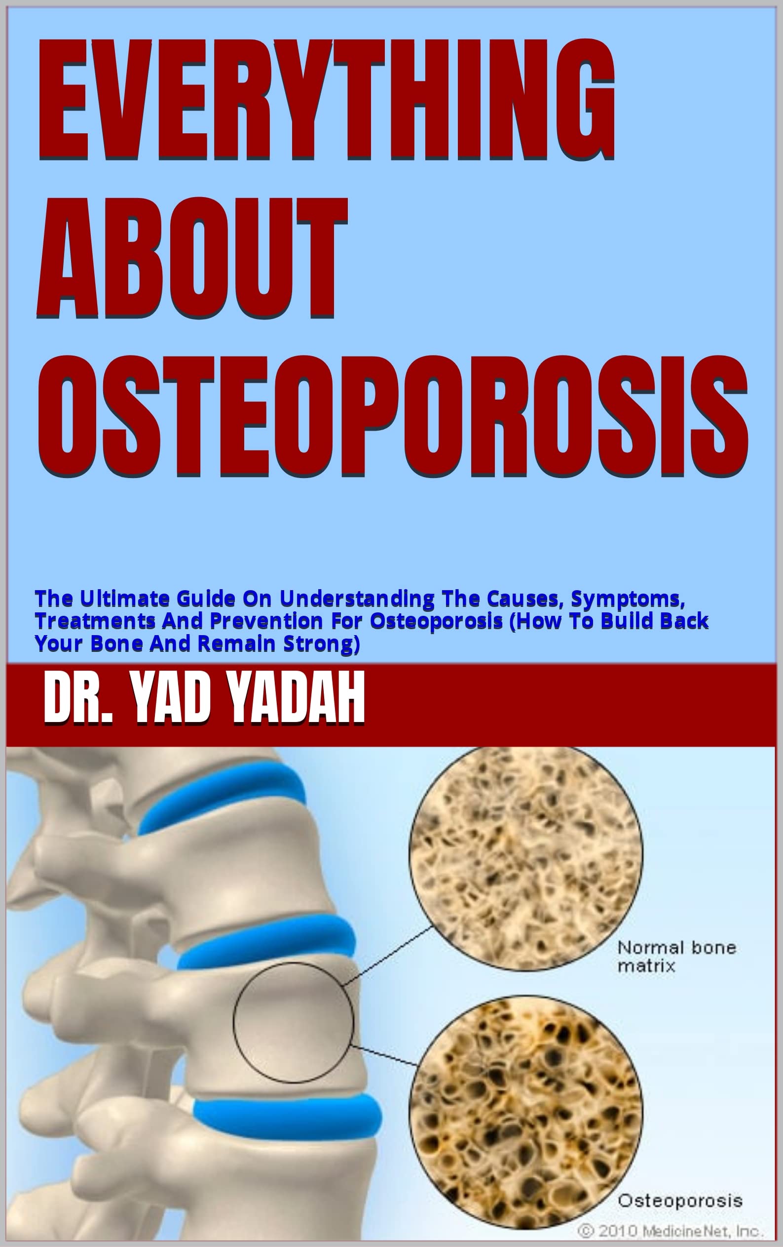 Buy EVERYTHING ABOUT OSTEOPOROSIS The Ultimate Guide On Understanding