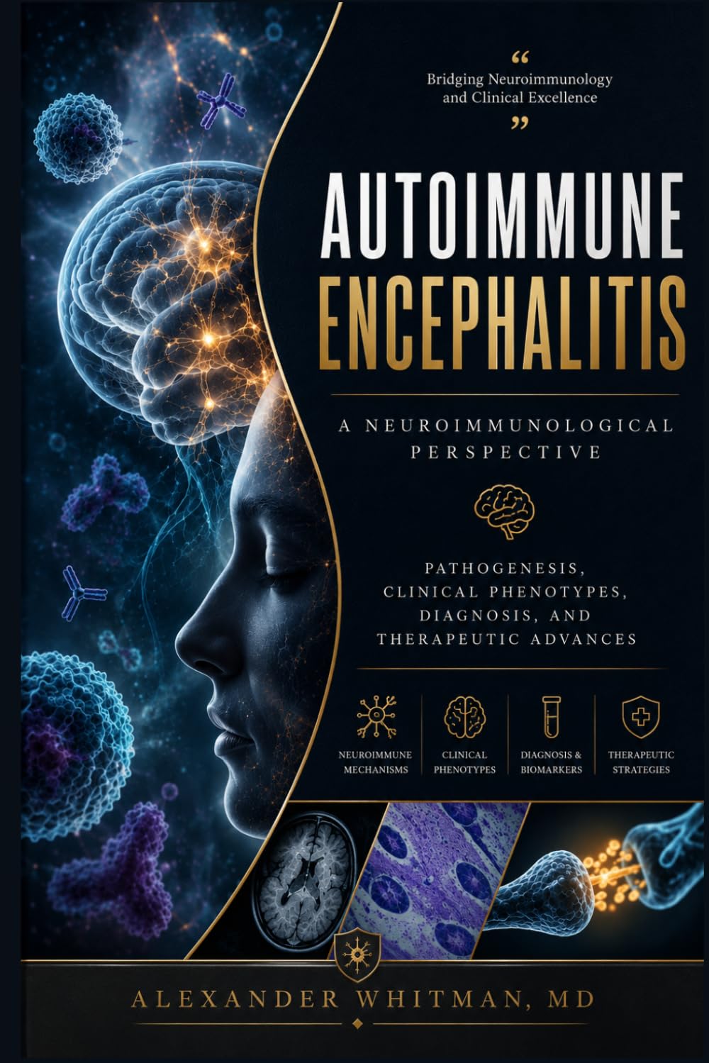 Autoimmune Encephalitis: A Neuroimmunological Perspective: Pathogenesis, Clinical Phenotypes, Diagnosis, and Therapeutic Advances