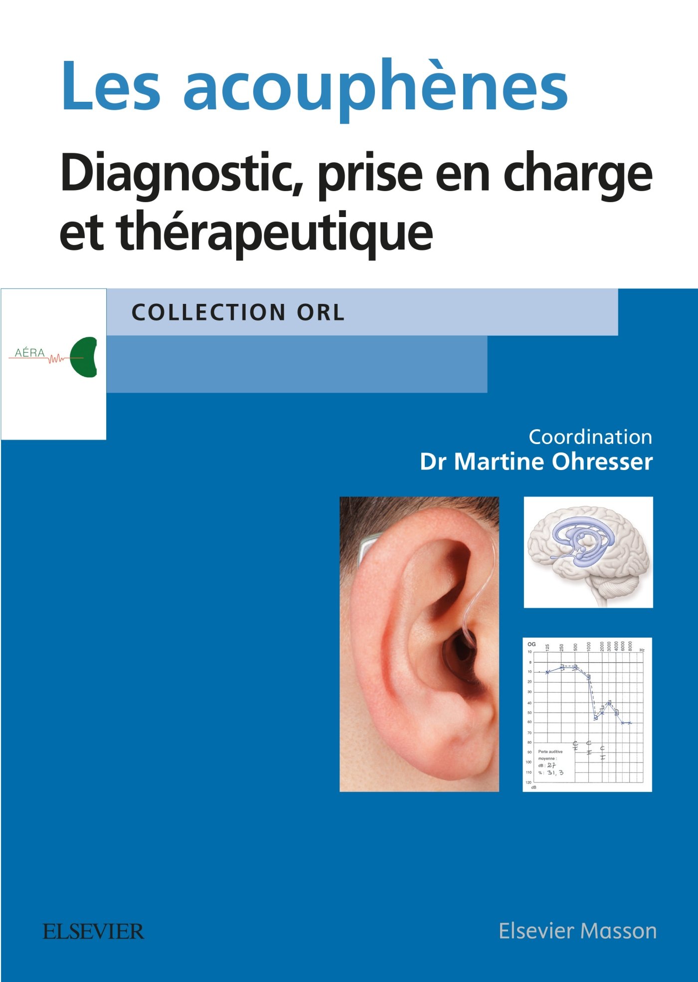 Les acouphènes: Diagnostic, prise en charge et thérapeutique