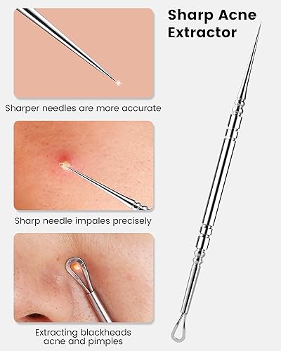 Miniatura 3 de Kit de herramientas para reventar espinillas, kit de 6 piezas de extracción de puntos negros, kit extractor de comedones con caja para eliminación
