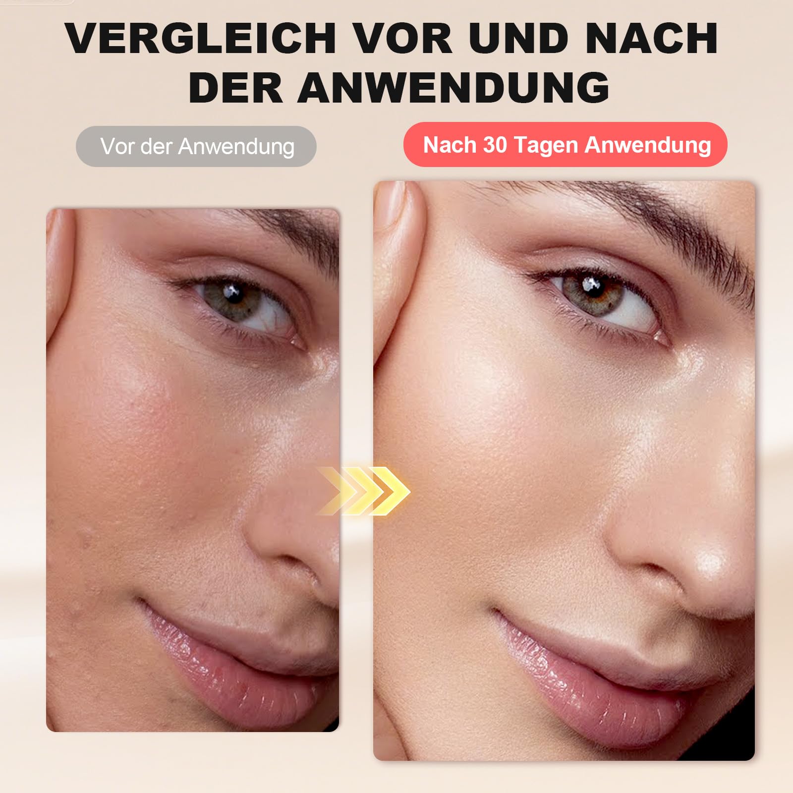 3 in 1 Schröpfmassagegerät Modellierung und Straffung | 5 Stufen, Lymphdrainage & Muskelentspannung für Bauch, Beine, Po, Faszien, Modellierung Straffung für Körper Gesicht
