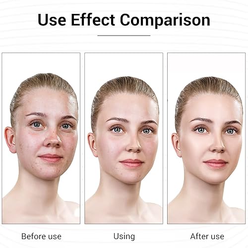 Miniatura 5 de Máscara facial L E D terapia de luz, 7 colores L E D, terapia de luz roja y azul para cara, máscara ligera para el cuidado de la piel, recargable