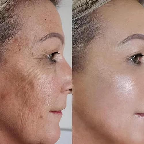 Miniatura 6 de AHA 30% + BHA 2% Solución de pelado, ácido glicólico con ácido láctico, AHA BHA Exfoliante para poros grandes, arrugas y líneas finas, exfoliante